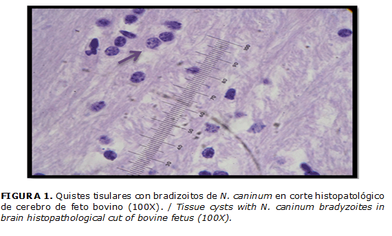 FIGURA 1. Quistes tisulares con bradizoitos de N. caninum en corte histopatol&oacute;gico de cerebro de feto bovino (100X). / Tissue cysts with N. caninum bradyzoites in brain histopathological cut of bovine fetus (100X).