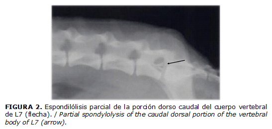 FIGURA 2. Espondil&oacute;lisis parcial de la porci&oacute;n dorso caudal del cuerpo vertebral de L7 (flecha). / Partial spondylolysis of the caudal dorsal portion of the vertebral body of L7 (arrow).